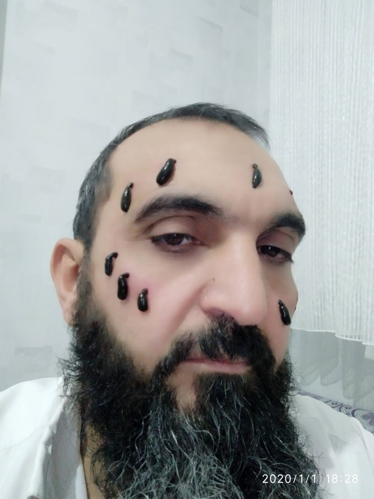 Konya hacamat